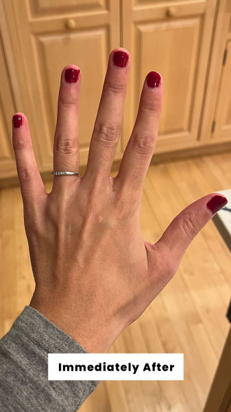 Allure contributing commerce editor Deanna Pai immediately after applying the Olive June Long Lasting Nail Polish